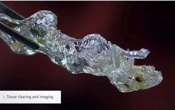 黑科技丨首次實現人體器官透明成像，讓疾病無處遁形！