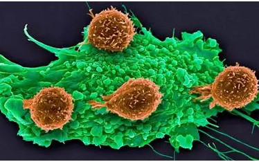 Science：基因編輯聯合細胞療法，首次進入臨床試驗！
