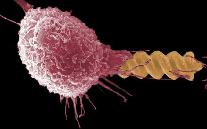 Science子刊：微型顆粒如何“鉆”進和影響免疫系統？