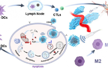 ACS Nano：超聲催化調(diào)節(jié)腫瘤自噬以增強(qiáng)免疫治療