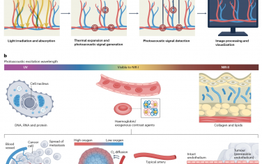 Nature Reviews Bioengineering：光聲成像的臨床轉(zhuǎn)化