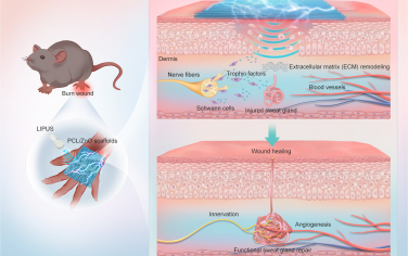 ACS Nano:柔性聲壓貼片通過內源性微環境重塑修復功能性汗腺