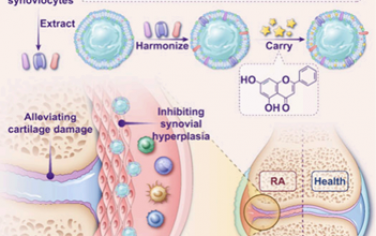 Nano Lett：仿生納米顆粒可抑制HIF-1α/iNOS/NLRP3通路緩解類風濕關節炎