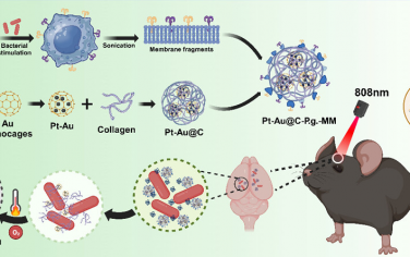 ACS Nano：膠原酶可降解仿生納米籠通過(guò)靶向腦內(nèi)抗菌光熱與氣體療法緩解牙齦卟啉單胞菌介導(dǎo)的神經(jīng)認(rèn)知功能障礙