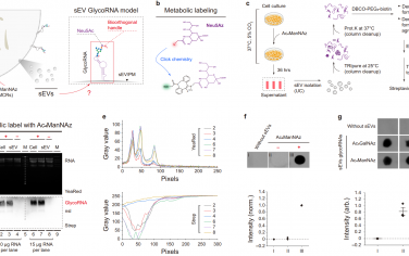 Nat. Commun：對小胞外囊泡上的glycoRNA進行FRET成像以實現敏感的癌癥診斷