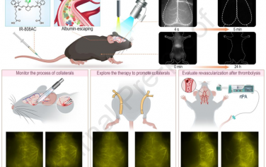 Biomaterials：新型的NIR-II白蛋白逃逸探針用于對卒中小鼠模型進行腦動脈和灌注成像