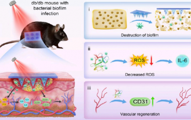 Nano Lett：具有消除生物膜和血管生成作用的光熱共軛聚合物微針用于促進(jìn)糖尿病創(chuàng)面愈合