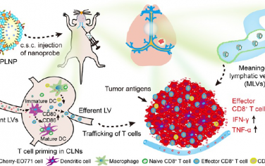 ACS Nano：靶向調節腦膜淋巴逆行通路以實現乳腺癌腦轉移免疫治療