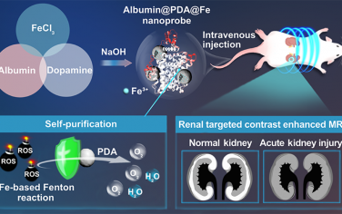 ACS Nano：具有自凈化能力的仿生納米探針用于急性腎損傷的靶向磁共振成像