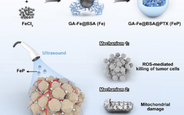 Biomaterials：超聲增強(qiáng)的納米催化劑可通過鐵死亡-凋亡聯(lián)合策略治療轉(zhuǎn)移性葡萄膜黑色素瘤