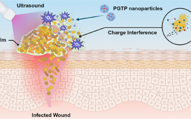Nano Lett：超聲驅動的電荷干擾療法用于治療傷口感染