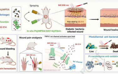 Biomaterials：近紅外光激活的鎮痛納米復合材料遞送系統用于治療大鼠糖尿病創面