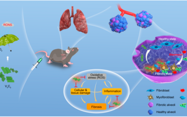 ACS Nano：具有廣譜抗氧化活性的碳化釩納米片用于肺纖維化治療