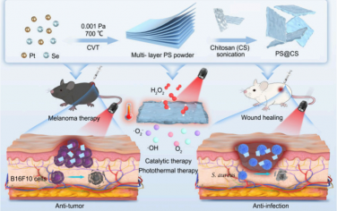 Nano Lett：NIR-II光驅(qū)動(dòng)的多功能納米酶用于治療黑色素瘤和腫瘤手術(shù)后感染