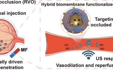 ACS Nano：混合生物膜功能化的納米機器人可穿透眼玻璃體以治療視網膜靜脈閉塞