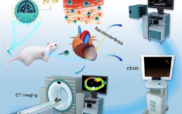 ACS Nano：靶向膠原的自組裝納米探針用于對心肌梗死大鼠模型的心肌纖維化進行多模態分子成像和定量