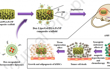 Biomaterials：智能復合支架可同步實現(xiàn)磁熱和化療以有效治療乳腺癌