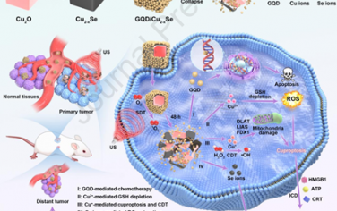Biomaterials：響應TME的異質結工程化納米藥物可實現腫瘤特異性銅死亡和化療增強的超聲免疫治療