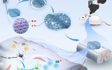 ACS Nano：雪旺細胞源性外泌體和甲潑尼龍復合貼片用于脊髓損傷修復