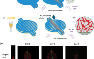 AFM：具有集成血管層次的厚脂肪組織的 3D 生物打印