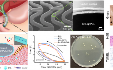 Bioactive Materials：具有納米工程表面的3D打印多功能膽道支架用于抗增生和抗生物膜形成